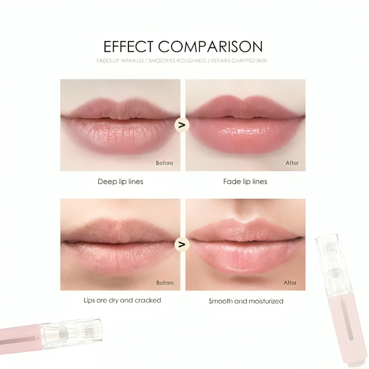 50 % DE RABAIS TEMPORAIRE | LipLift™ | Rouleau à lèvres micro-aiguille