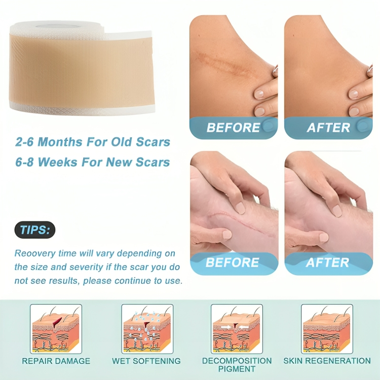 1 + 1 GRATUIT AUJOURD'HUI | SkinMend™ | Feuilles de silicone pour cicatrices