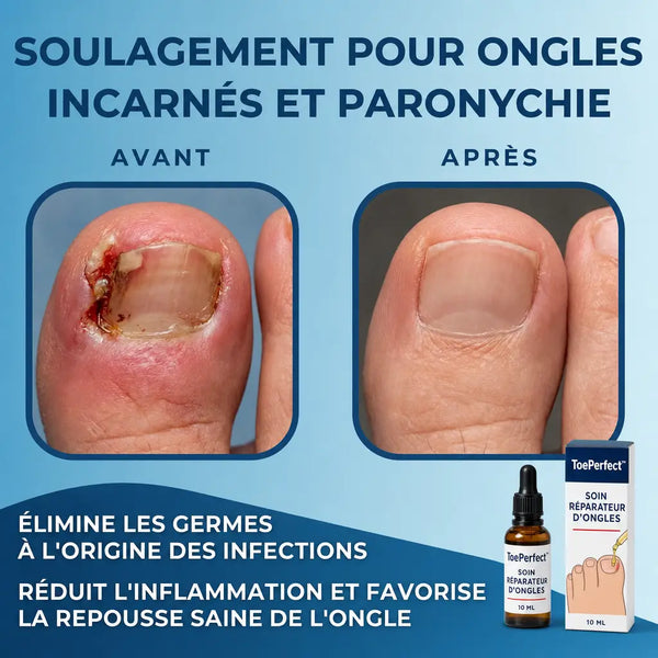 1+1 OFFERT · AUJOURD