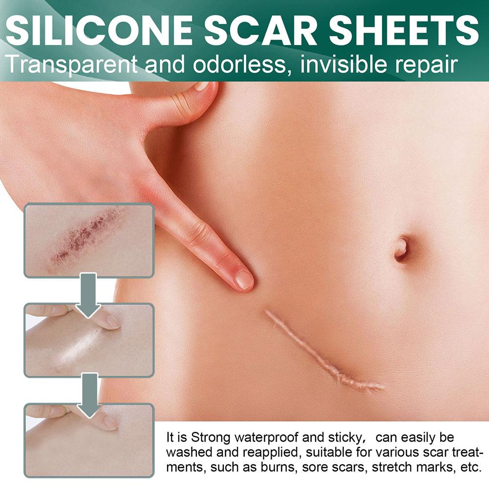 1 + 1 GRATUIT AUJOURD'HUI | SkinMend™ | Feuilles de silicone pour cicatrices